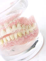 Dental dentures